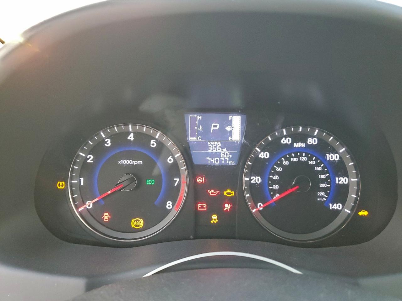 Hyundai ACCENT Se Image 6